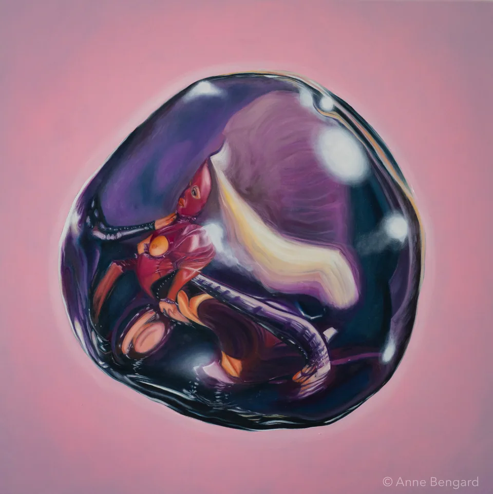ANNE BENGARD